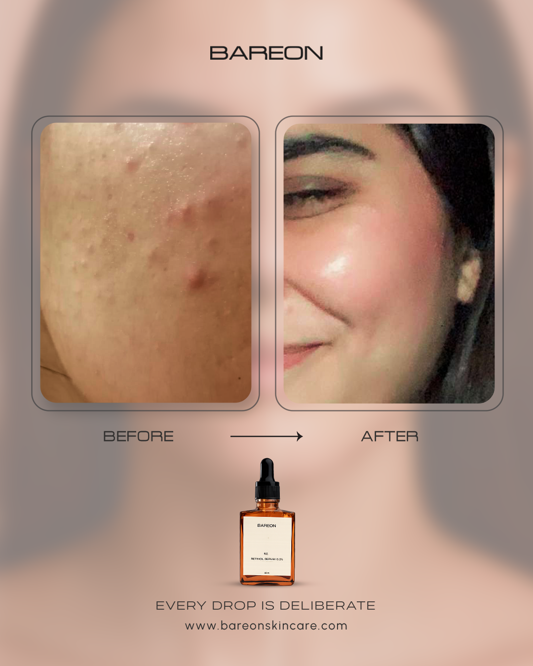 Real results - Bareon skincare before and after