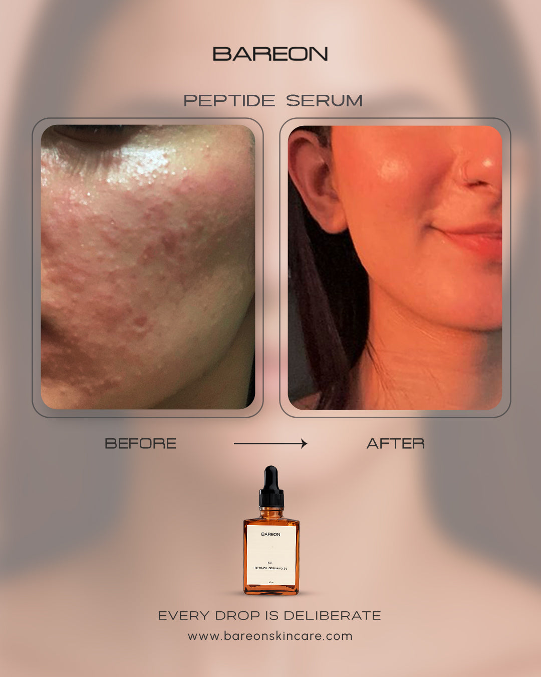 Before and after using Bareon Peptide Complex Serum